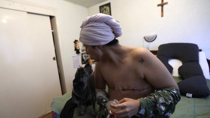 Imagem de Cancro de mama com impacto elevado na vida dos doentes