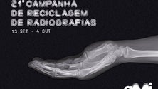 Imagem de AMI lança campanha de reciclagem de radiografias