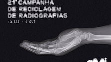 AMI lança campanha de reciclagem de radiografias