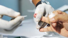 Imagem de Madeira quer erradicar Hepatite C dentro de dez anos