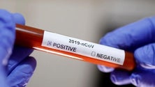 Imagem de Covid-19: Portugal com 762 mortos e 21.379 infetados