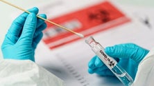 Imagem de Covid-19: Espanha regista oito mortes e 149 novos casos nas últimas 24 horas