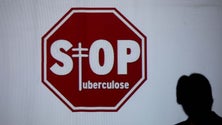 Imagem de Casos de tuberculose em Portugal diminuíram