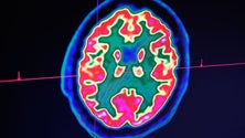 Imagem de Circuito cerebral associado ao consumo de cocaína