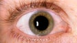 Imagem de Utentes aderem ao rastreio à retinopatia diabética (áudio)