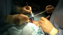 Imagem de Primeiro transplante de fígado em Portugal foi no Curry Cabral há 30 anos