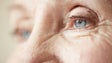 Cataratas é a principal doença ocular que afeta os madeirenses
