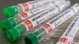 EMA autoriza nova técnica de injeção da vacina para cobrir mais pessoas