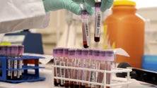 Imagem de China promete analisar amostras de sangue anteriores ao surto em Wuhan