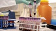 Imagem de China promete analisar amostras de sangue anteriores ao surto em Wuhan