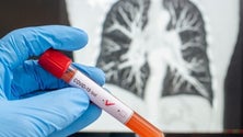 Imagem de Covid-19: Mortalidade com diminuição consistente desde 15 de abril