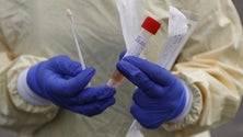 Imagem de Covid-19: SESARAM tem capacidade para realizar 50 testes por dia (Vídeo)
