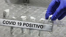 Imagem de Mais duas mortes e 612 novos casos
