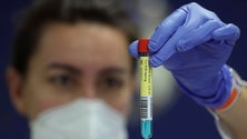 Imagem de Detetados 174 casos no despiste ao sexto dia nos Açores