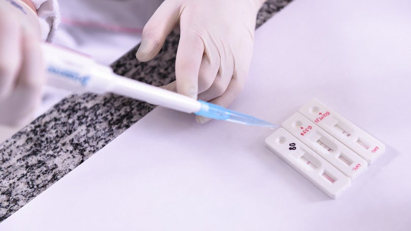 Imagem de Mais de 100 mil testes à Covid-19 processados no laboratório do SESARAM