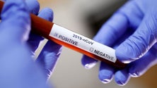 Imagem de Covid-19: Espanha com 141 novos casos e 30 mortes na última semana