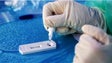 Açores com 17 novos casos de infeção