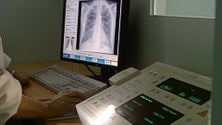 Imagem de Governo quer implementar rastreio ao cancro do pulmão