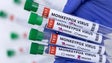 Imagem de Monkeypox: Casos aumentam para 14.000 em mais de 70 países