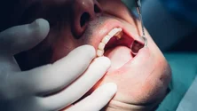 Imagem de Mais de 300 dentistas disponibilizaram-se para apoiar refugiados