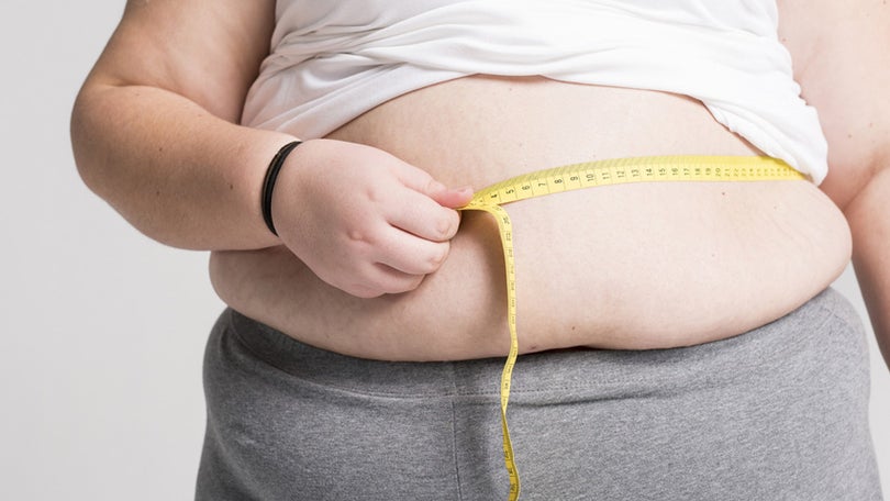 Imagem de Especialista defende mais campanhas contra obesidade na Madeira