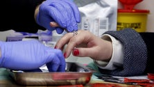 Imagem de DGS alerta para a necessidade de realização de testes das hepatites e do VIH