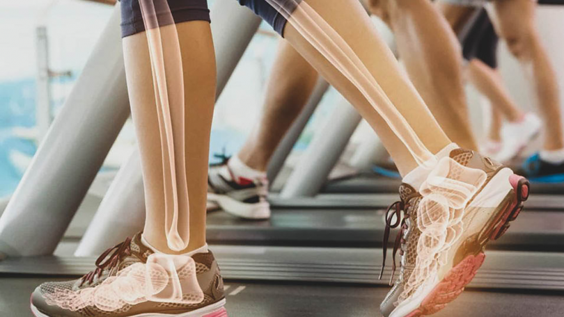 Imagem de Confinamentos pioraram casos de osteoporose