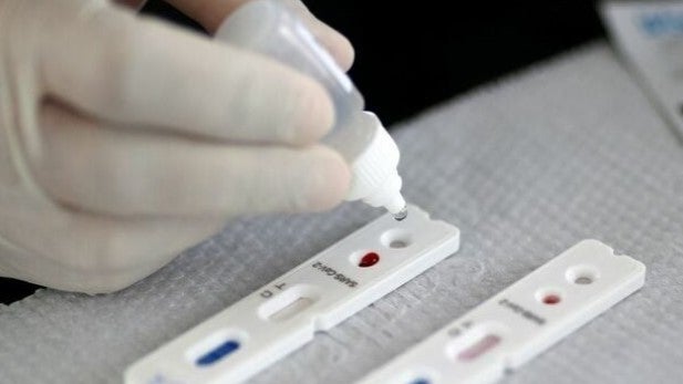 Imagem de OMS recomenda testes nas escolas