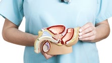 Imagem de 127 novos casos de cancro na próstata, detetados todos os anos na Madeira