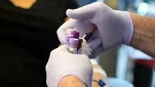 Imagem de Cinco casos confirmados de infeção pelo vírus Monkeypox em Portugal