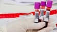 Imagem de Despesa pública com análises clínicas duplica com a pandemia e atinge 378 milhões de euros