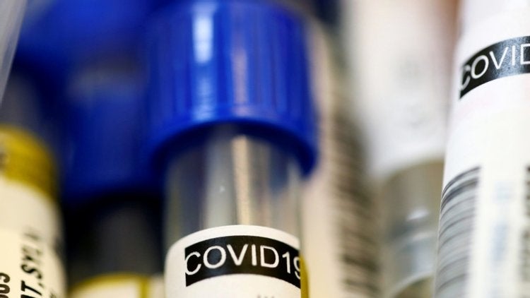 Covid-19: Mais 84 mortes e 2.638 novos casos