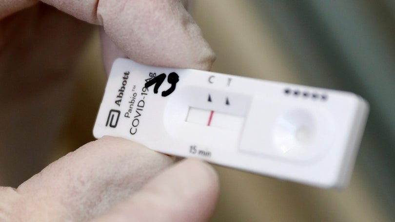 Imagem de Farmácias fazem 304 mil testes em dois dias
