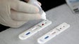 Imagem de Covid-19: Autoridades de saúde permitem testes rápidos mas com ponderação e reserva