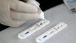 Covid-19: Autoridades de saúde permitem testes rápidos mas com ponderação e reserva