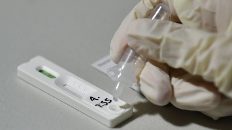Testes rápidos de antigénio passam a ter validade de 24 horas