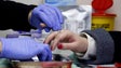 Testes de VIH vão poder ser feitos na farmácia