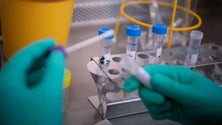 Imagem de Covid-19: INSA vai estudar amostras de doentes com infeção anormalmente longa