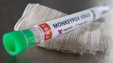 Imagem de Monkeypox: Casos confirmados sobem para os 317 em Portugal