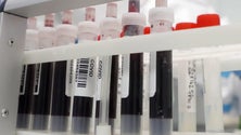 Imagem de Covid-19: Portugal regista 145 novos casos