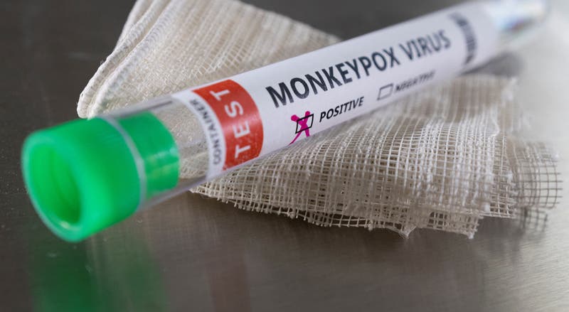 Monkeypox: Portugal já recebeu primeiras 2.700 doses de vacinas
