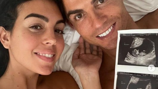 Ronaldo vai ser pai de gémeos