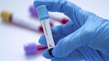 Imagem de Açores: medidas de combate à pandemia revistas em março (Vídeo)