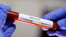 Imagem de Covid-19: Alemanha regista quase 174 mil casos e deteta novo foco em matadouro