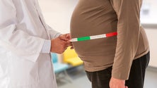 Imagem de Covid-19: Estão reunidas todas as condições para aumento da obesidade em Portugal