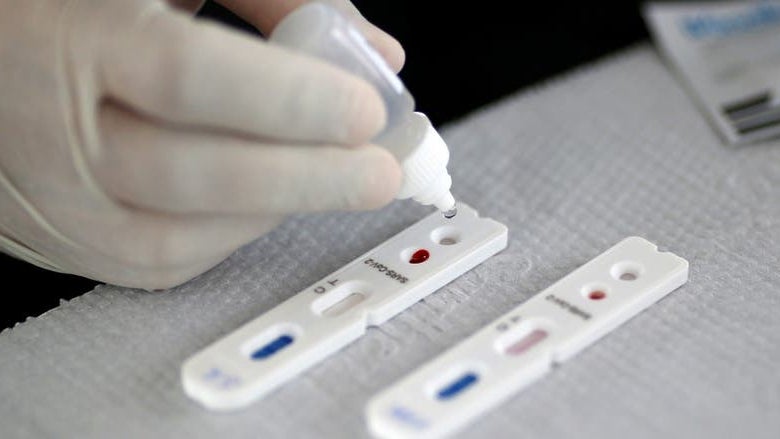 Imagem de Farmácias venderam mais de um milhão de testes rápidos