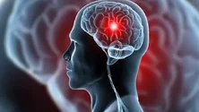 Imagem de Investigadores vão criar próteses inteligentes para prevenir acidentes cardiovasculares