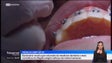 Ordem dos médicos dentistas pede reforço de meios humanos (vídeo)