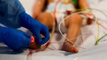 Imagem de Hepatite aguda causa a morte a cinco crianças