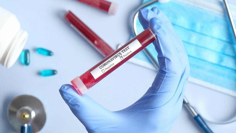 Imagem de Covid-19: Portugal com mais seis mortos e 451 novos casos confirmados